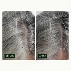 Routine de croissance des cheveux de Norwegian Biolabs pour les femmes avec des résultats cliniquement prouvés en 45 jours | Traitement contre la chute des cheveux (Bio-Pilixin) Naty Shop Soins Capillaires