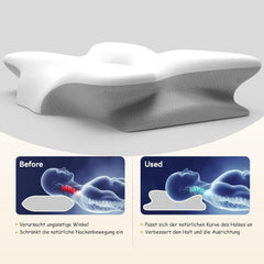 Oreiller cervical ergonomique en mousse à mémoire de forme avec housse amovible et lavable pour sommeil orthopédique, douleurs cervicales et douleurs abdominales (55 x 35 x 13 cm) Naty Shop Oreillers orthopédiques cervicaux