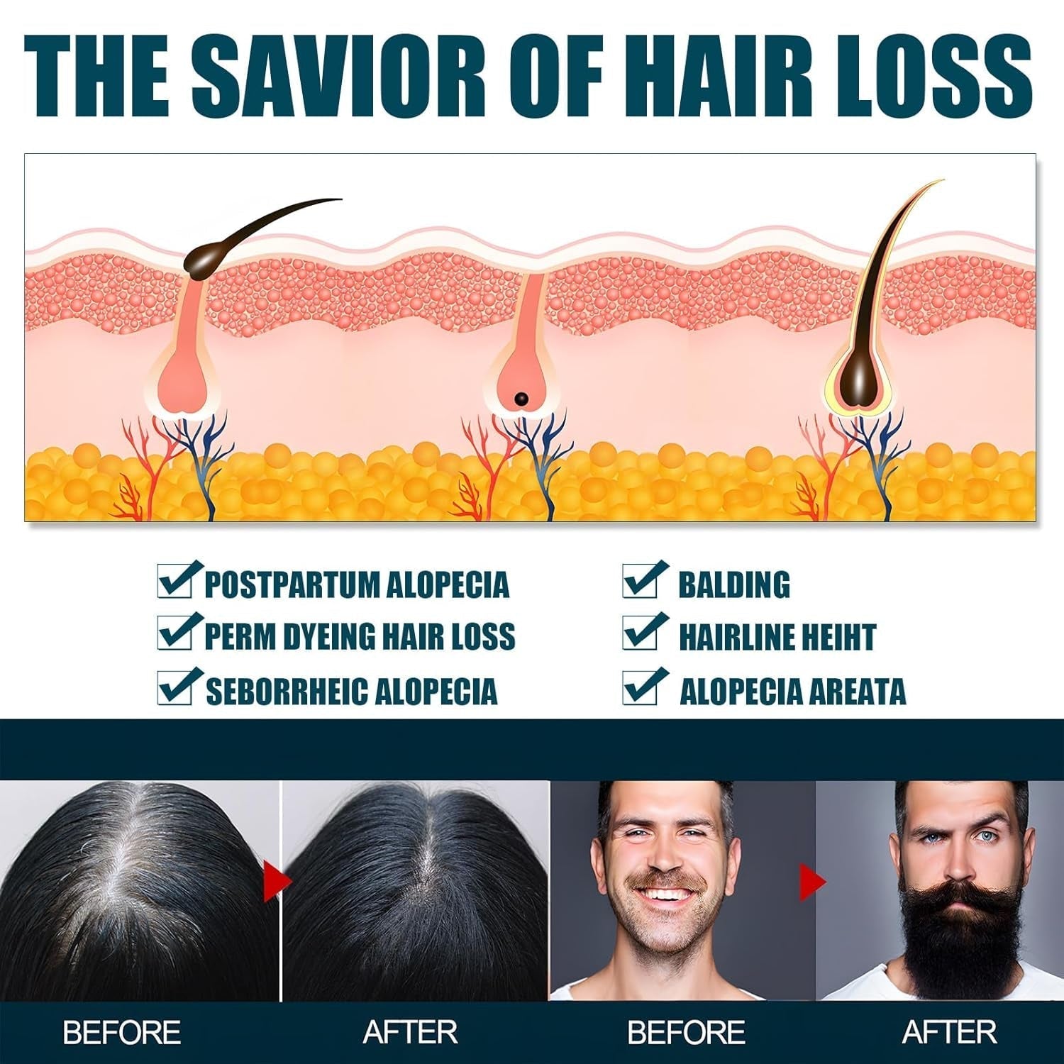 Sérum de croissance des cheveux Miioto, produit de croissance des cheveux pour hommes 180ML, sérum de croissance des cheveux, soin du cuir chevelu favorise les cheveux plus épais nourrit le cuir chevelu et prévient la chute des cheveux Naty Shop