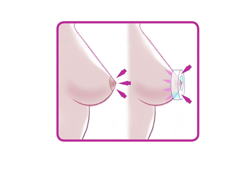 ELANEE Brust-Ringe, Schutz Der Brustwarze Bh-Kontakt Durch Hohllagerung, Ideal Bei Wunden, Entzündeten Brustwarzen Durch Stillen, 10 Stück (222-00) Accessoires Alimentation et allaitement Bebe Naty Shop