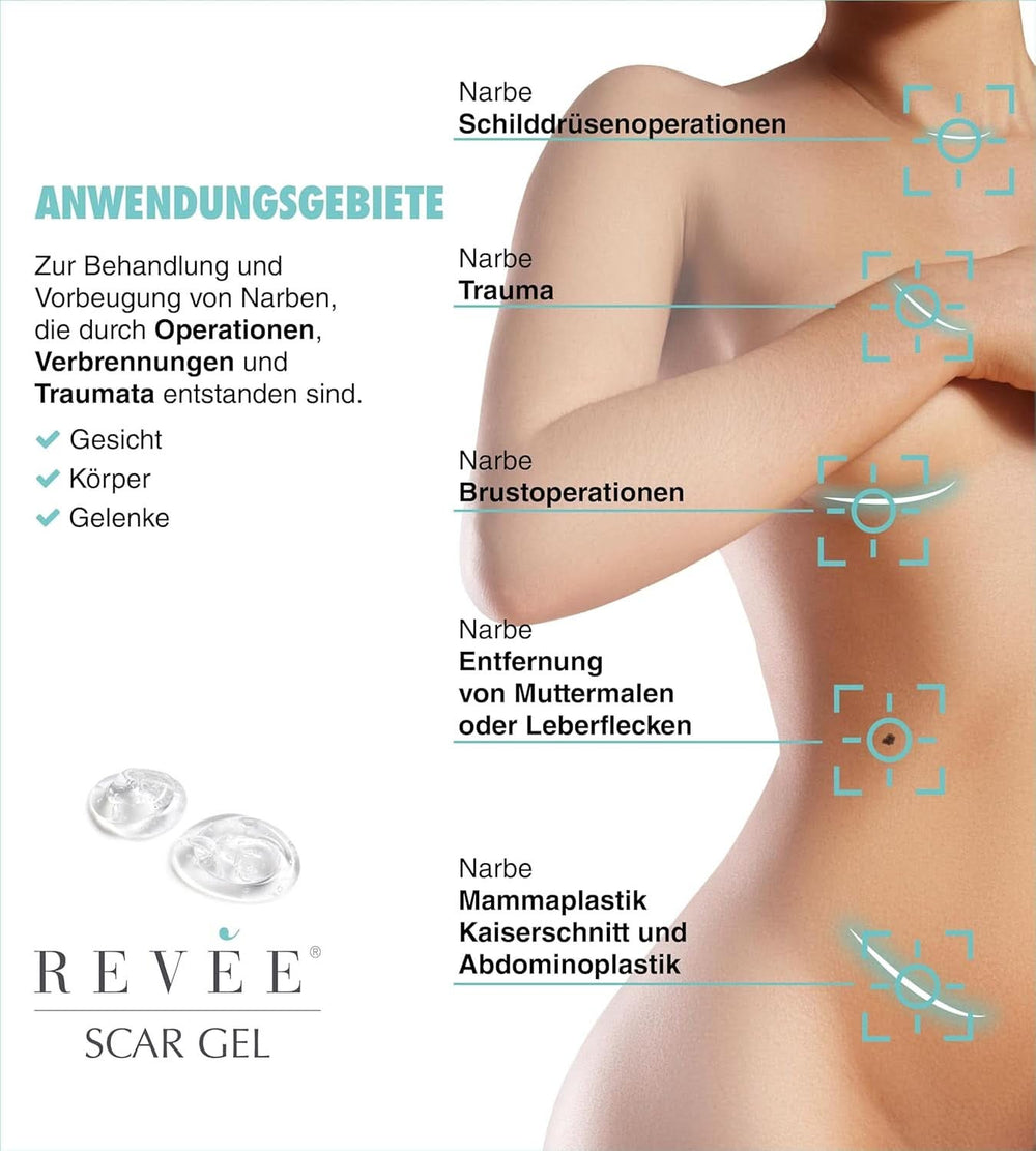 Revée Scar Gel, Gel topic pentru cicatrici Naty Shop