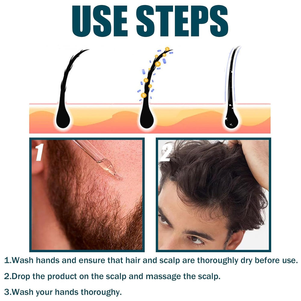 Miioto ser de creștere a părului, produs de creștere a părului pentru bărbați, ser de păr pentru creșterea părului, îngrijirea scalpului promovează părul mai gros hrănește scalpul și previne căderea părului, 3 * 60 ML Ingrijirea parului Naty Shop