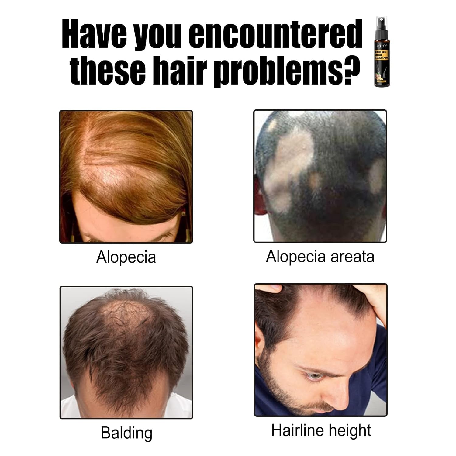 Kit de traitement avancé pour la croissance des cheveux 30 ml 2 pièces Spray pour la croissance des cheveux Rouleau de croissance des cheveux et ensemble d'essences Sérum pour la croissance des cheveux Anti-chute Sérum avancé pour la croissance des cheveux Soins capillaires Naty Shop