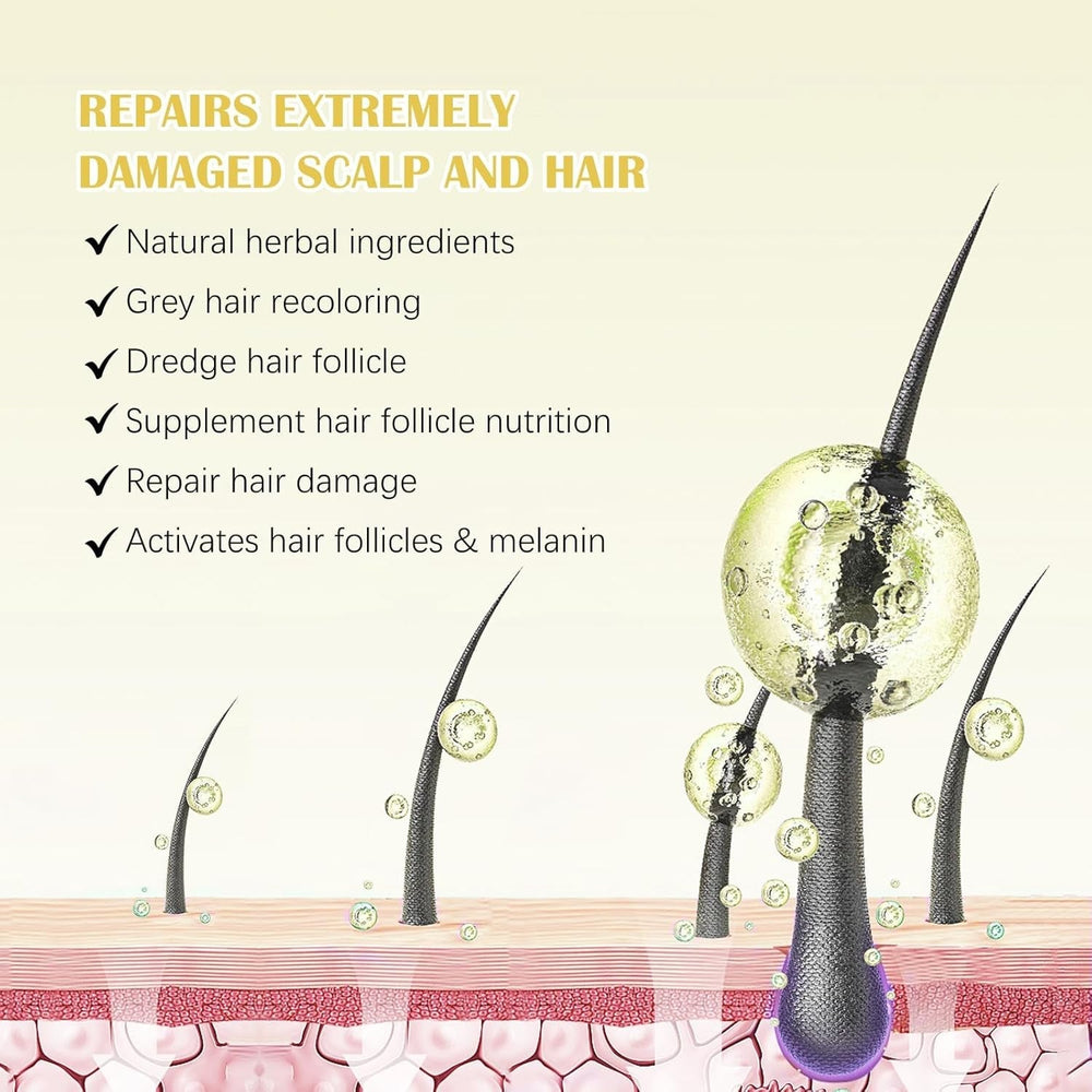 Huile de Croissance Capillaire Bio 5% - Solution Usage Externe - Croissance et Épaississement des Cheveux - Pour Chute de Cheveux Masculine et Cheveux Clairsemés - Réactive les Follicules Rétrécissants - Distributeur à Pompe Précis, 60ml Soin Capillaire Naty Shop