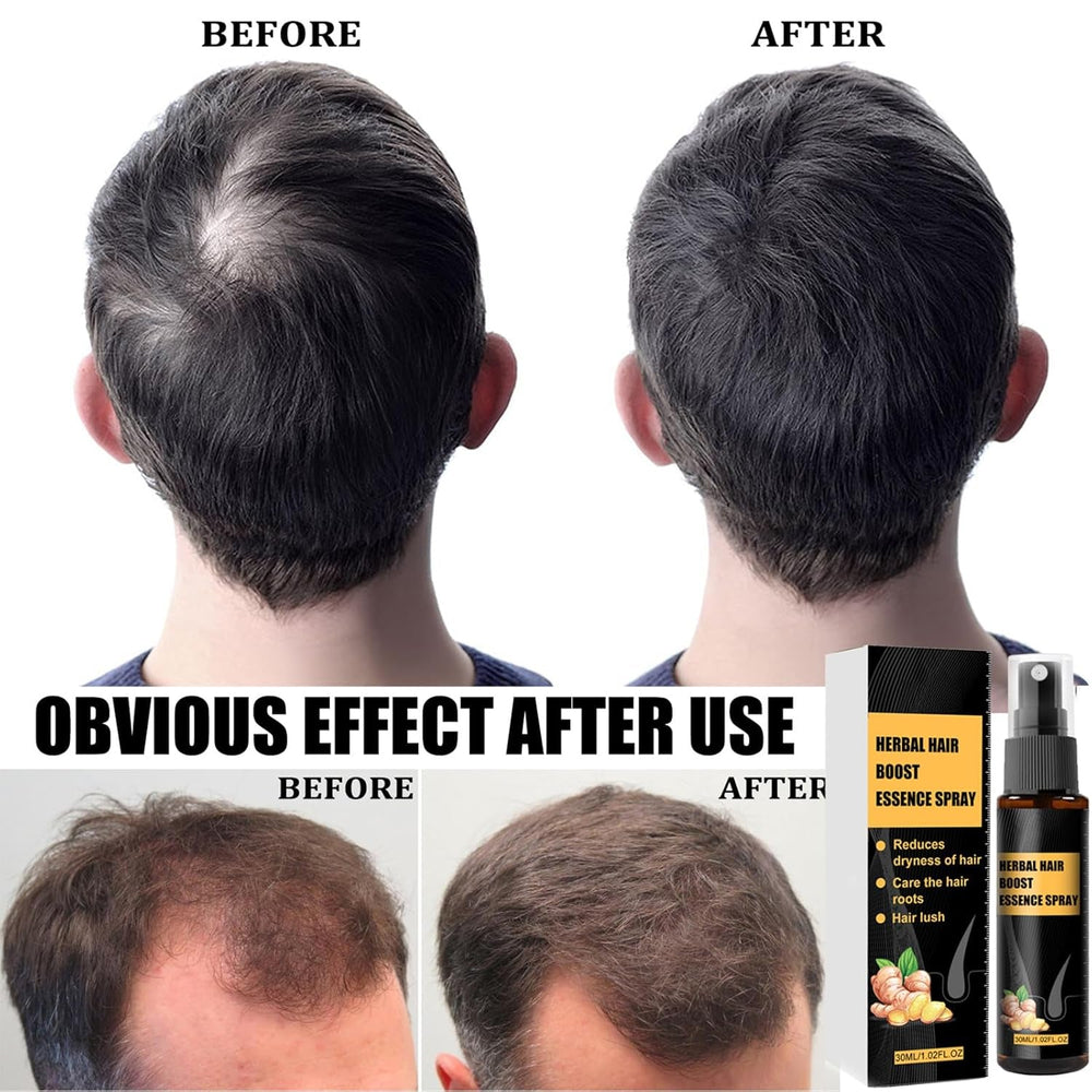 Kit de traitement avancé pour la croissance des cheveux 30 ml 2 pièces Spray pour la croissance des cheveux Rouleau de croissance des cheveux et ensemble d'essences Sérum pour la croissance des cheveux Anti-chute Sérum avancé pour la croissance des cheveux Soins capillaires Naty Shop