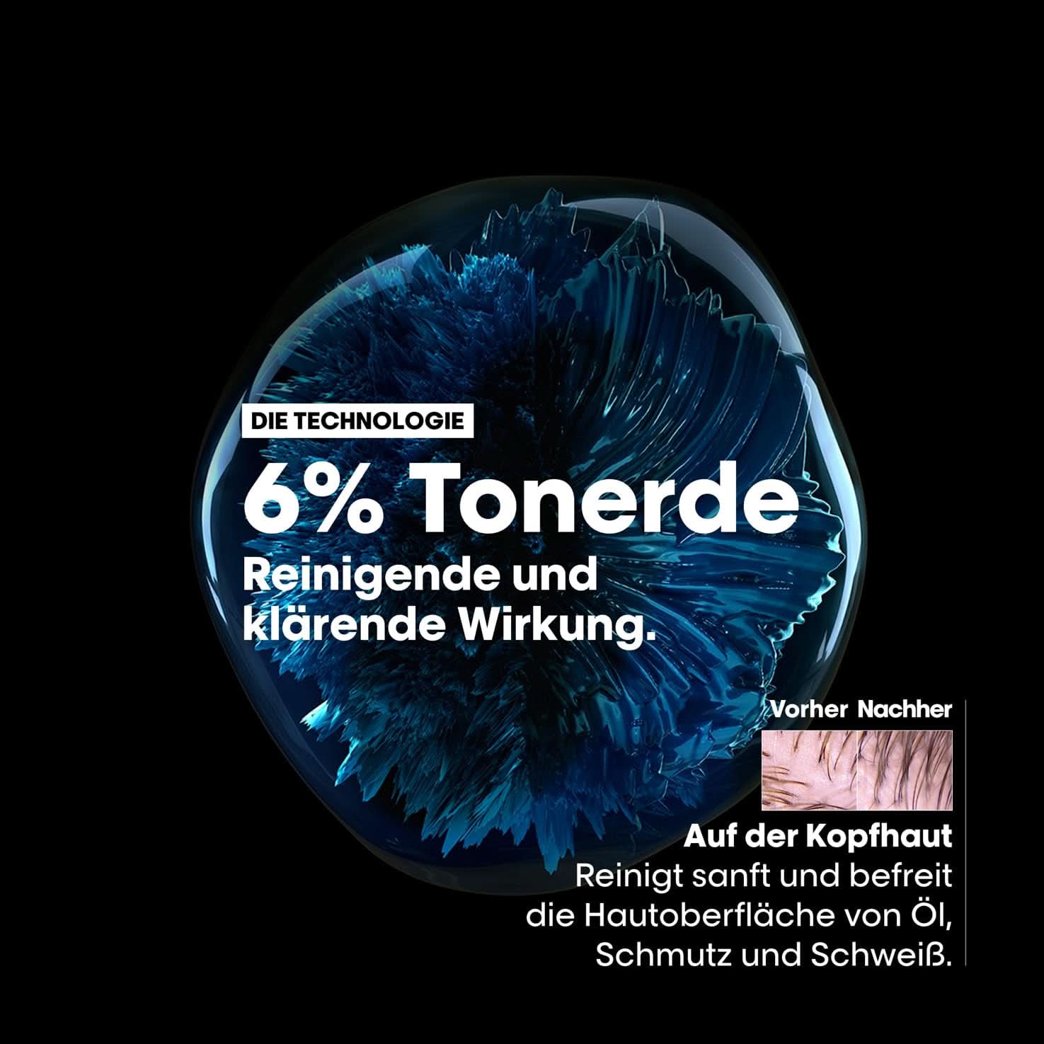 L'Oréal Professionnel Șampon de păr pentru curățarea scalpului gras, 300 ml Duș și baie Naty Shop