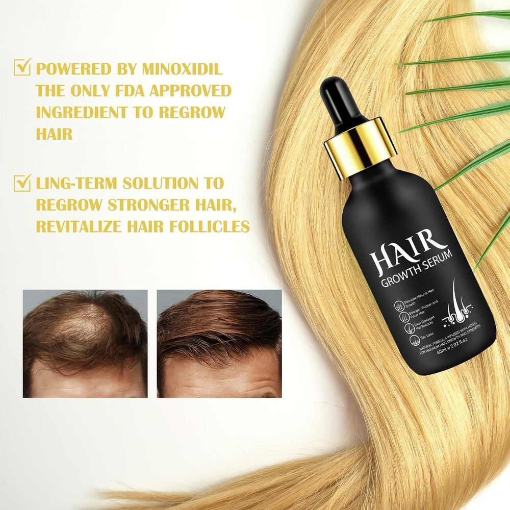 Huile de Croissance Capillaire Bio 5% - Solution Usage Externe - Croissance et Épaississement des Cheveux - Pour Chute de Cheveux Masculine et Cheveux Clairsemés - Réactive les Follicules Rétrécissants - Distributeur à Pompe Précis, 60ml Soin Capillaire Naty Shop