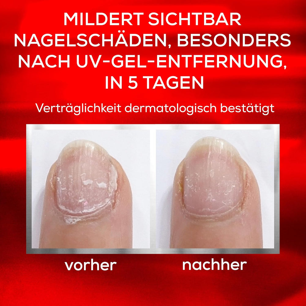 Essie Nail Rescue Kit : Huile pour ongles et cuticules parfumée à l'abricot + Vernis à ongles réparateur To the Rescue